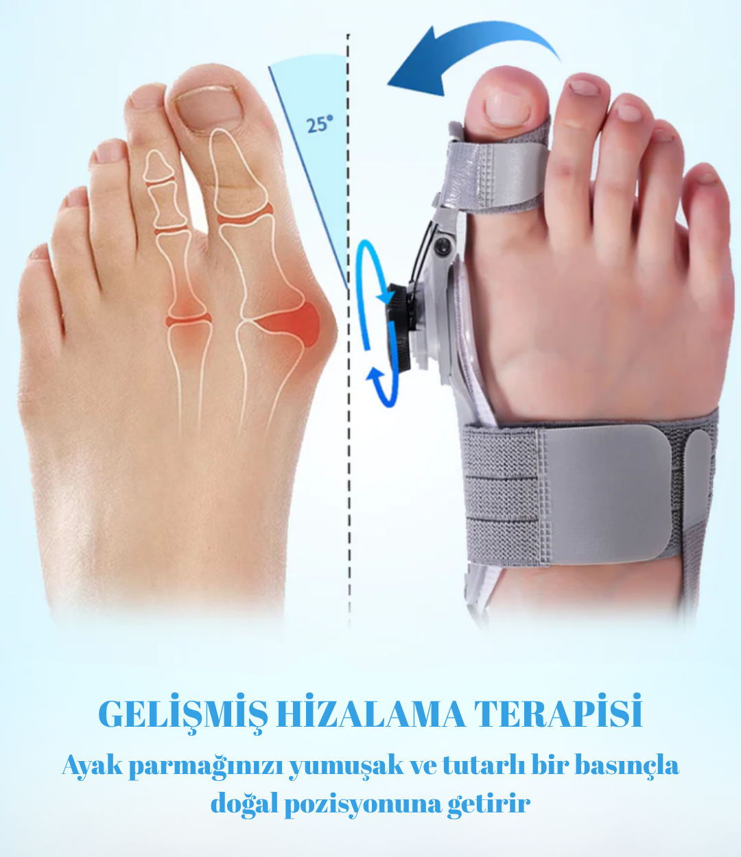 Halluks Valgus Ateli